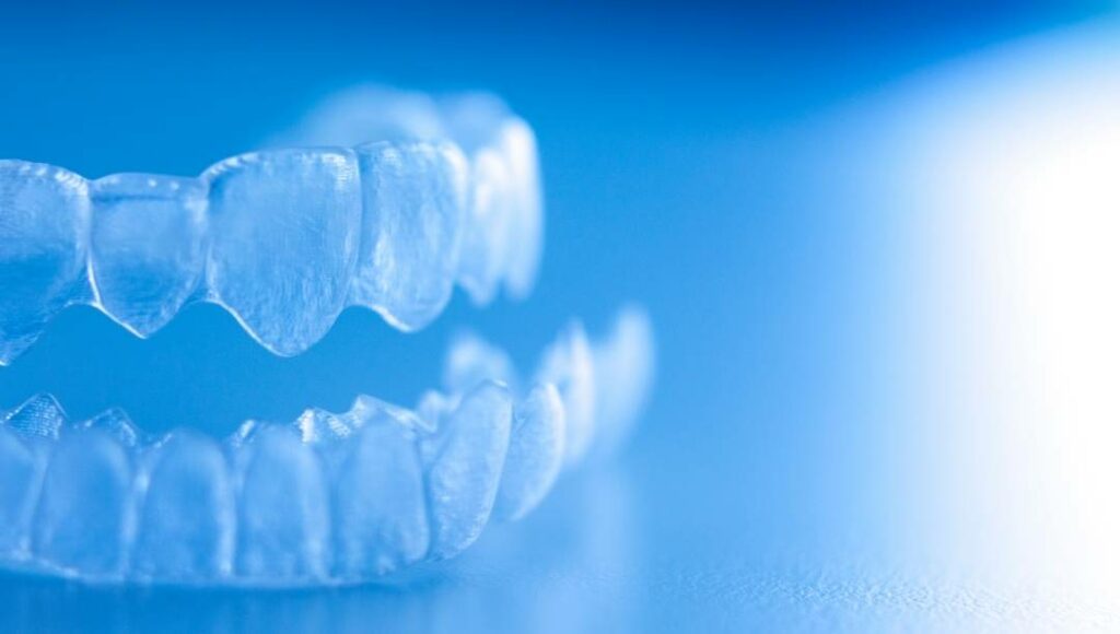 Invisalign, gouttières transparentes